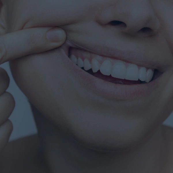 HB Dental Clinic Treatment Gum Contouring
